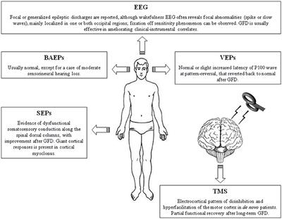 Neurophysiology of the “Celiac Brain”: Disentangling Gut-Brain Connections